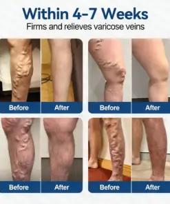 ๐๐๐๐น๐ฌ๐ก๐๐ยฎ ๐ฉ๐ฒ๐๐ ๐๐๐๐๐ผ๐ฎ๐ซ ๐๐ข๐๐ซ๐จ๐๐๐๐
๐น๐ฒ ๐ท๐๐๐๐ก