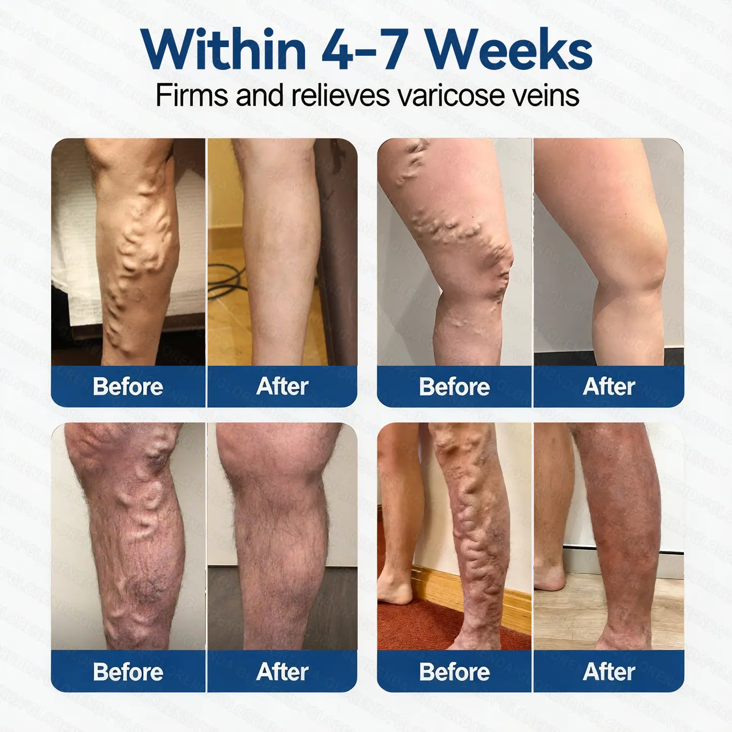 ๐๐๐๐น๐ฌ๐ก๐๐ยฎ ๐ฉ๐ฒ๐๐ ๐๐๐๐๐ผ๐ฎ๐ซ ๐๐ข๐๐ซ๐จ๐๐๐๐
๐น๐ฒ ๐ท๐๐๐๐ก