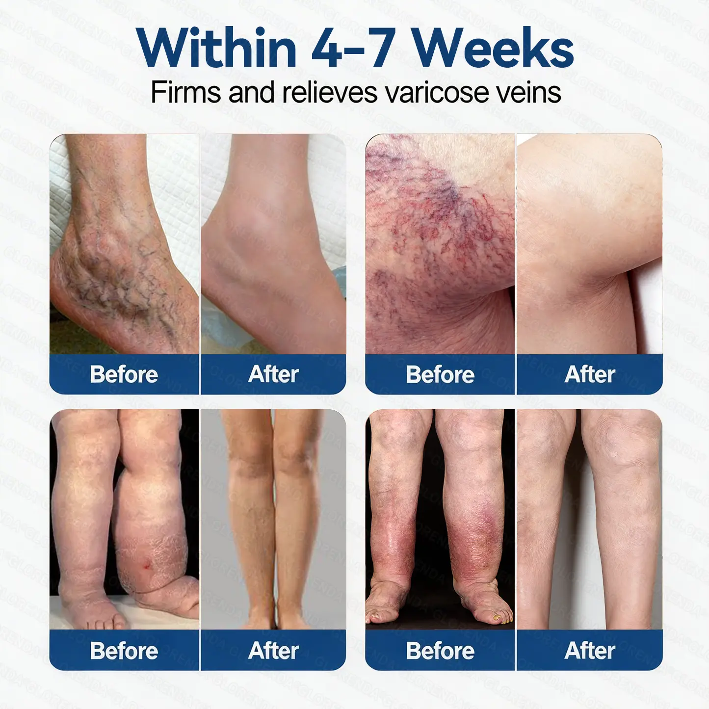 ๐๐๐๐น๐ฌ๐ก๐๐ยฎ ๐ฉ๐ฒ๐๐ ๐๐๐๐๐ผ๐ฎ๐ซ ๐๐ข๐๐ซ๐จ๐๐๐๐
๐น๐ฒ ๐ท๐๐๐๐ก